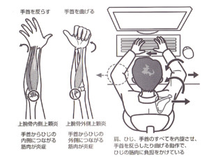 肘の痛みの原因と改善ストレッチ かなではり整体指圧 台東区上野 御徒町 整体 骨盤矯正
