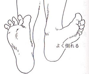 内股傾向と骨盤と肩甲骨の歪みの関係 かなではり整体指圧 台東区上野 御徒町 整体 骨盤矯正